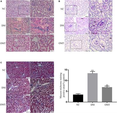 Oxymatrine Inhibits Twist-Mediated Renal Tubulointerstitial Fibrosis by Upregulating Id2 Expression